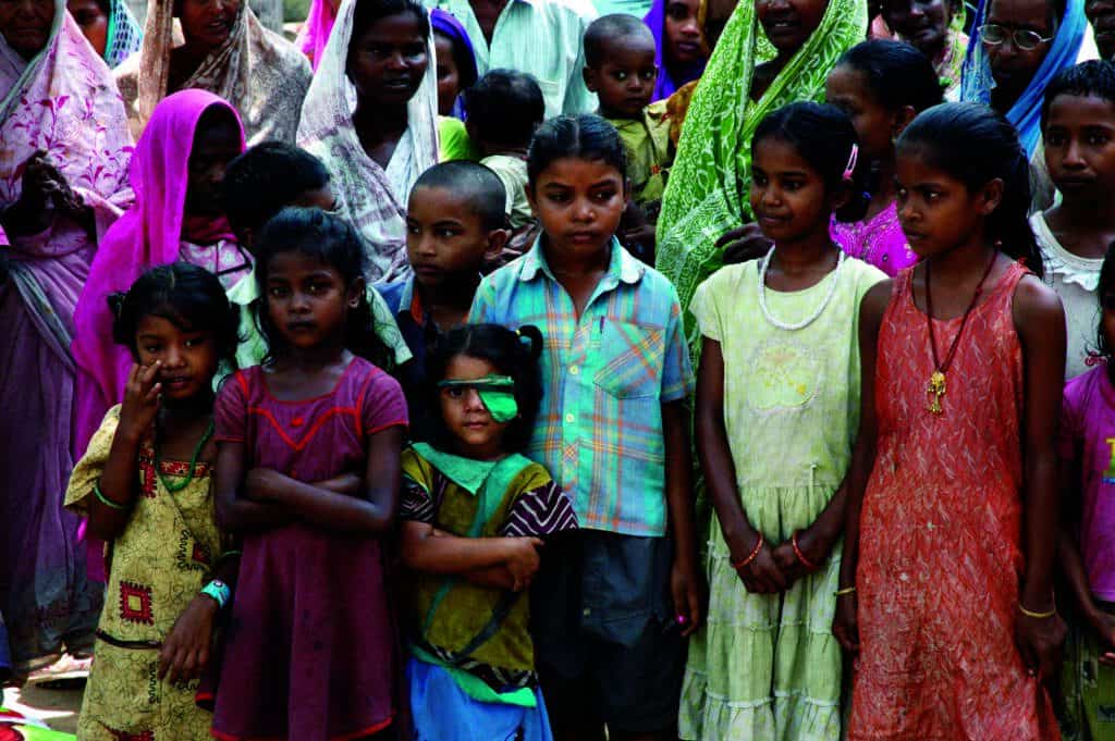 Outcast and Abandoned. A group of children at a leper colony.